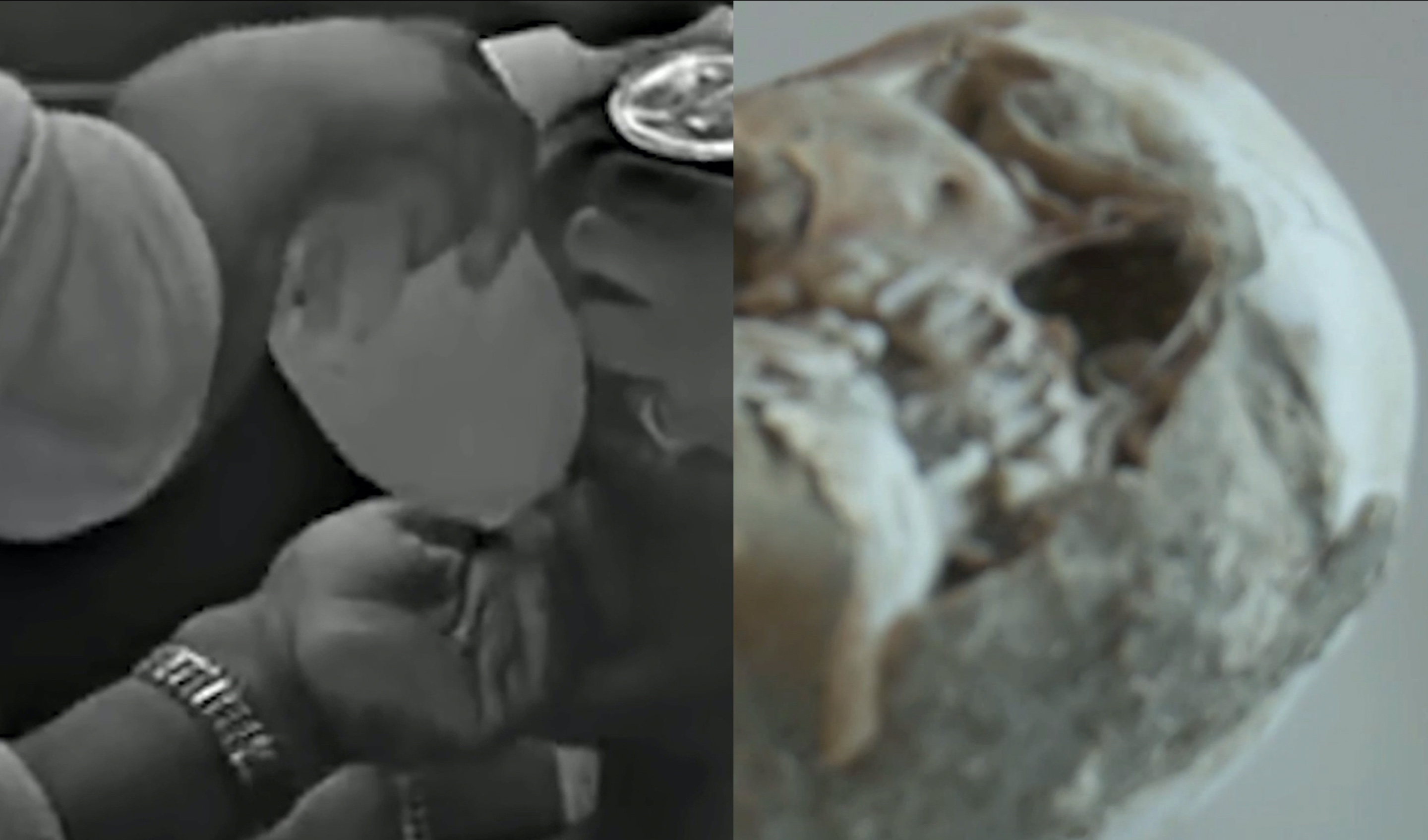 Zwei verpixelte Bilder in Grautönen, links Hände, rechts ein Schädel.